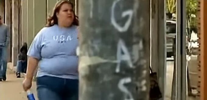 Excess weight - the cause of varicose veins