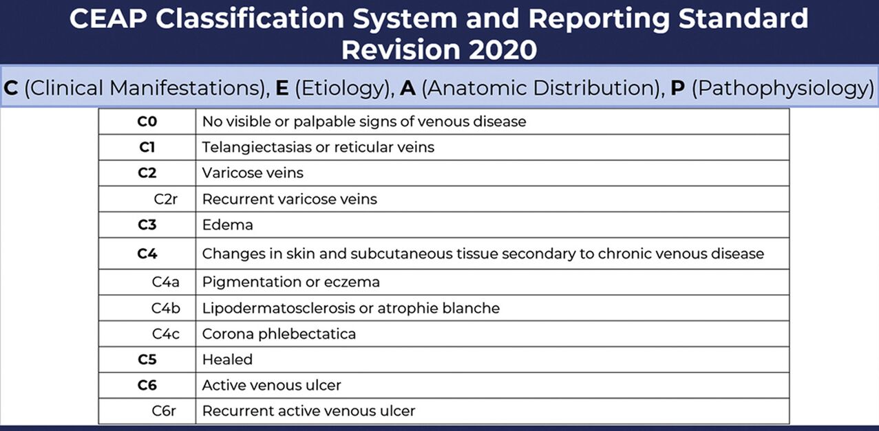 Stages of varicose veins according to the CEAP classification as amended in 2020